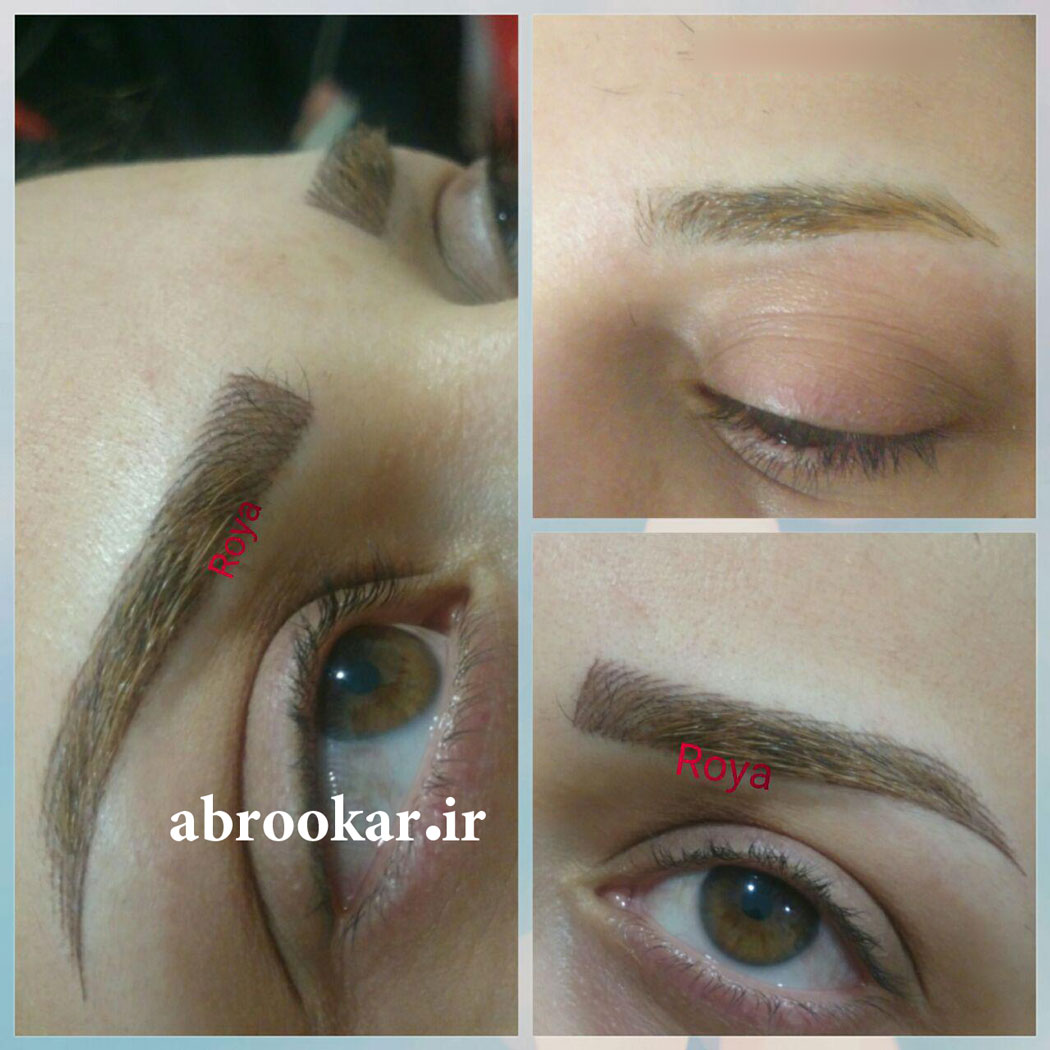 میکروپیگمنتیشن غرب تهران