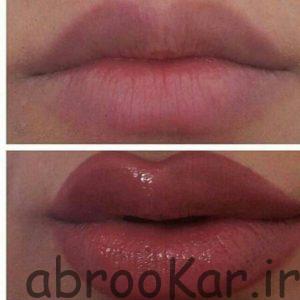 آموزش میکروپیگمنتیشن در شمال تهران