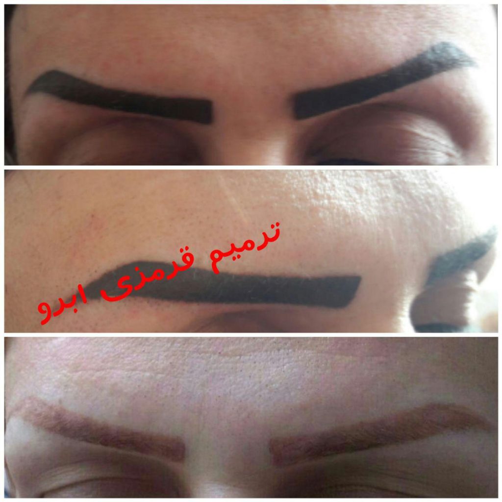 بهترین مرکز هاشور ابرو در تهران