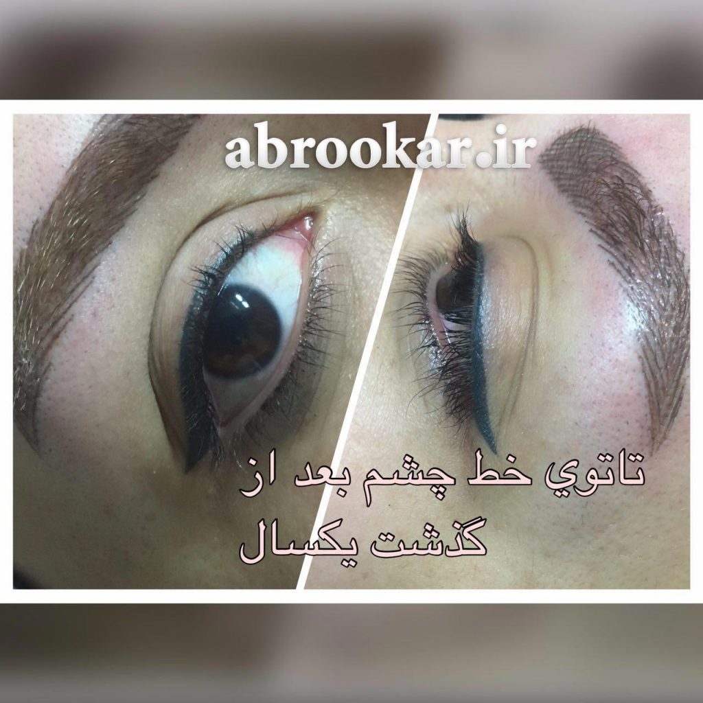 مراکز معتبر میکروپیگمنتیشن