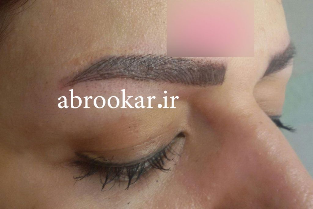 میکروبلیدینگ ابرو