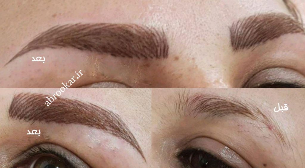 خدمات تاتو صورت تاتو صورت در تهران - تاتو ابرو در تهران - تاتو چشم در تهران - تاتو لب در تهران - تاتو ابرو در تهران