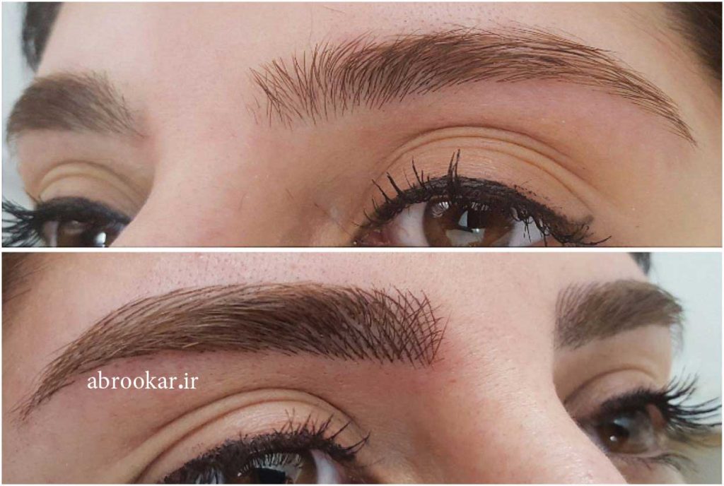 هاشور ابرو در محدوده دیباجی لواسانی پاسداران اختیاریه شمالی